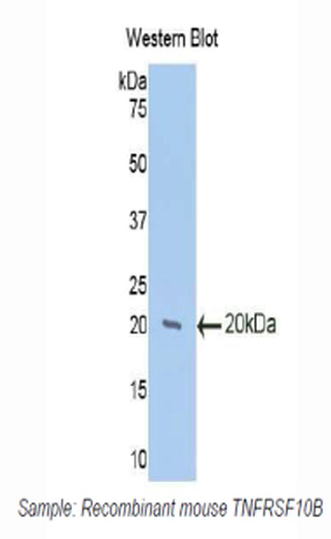 TRAIL-R2 (DR5) Antibody in Western Blot (WB)