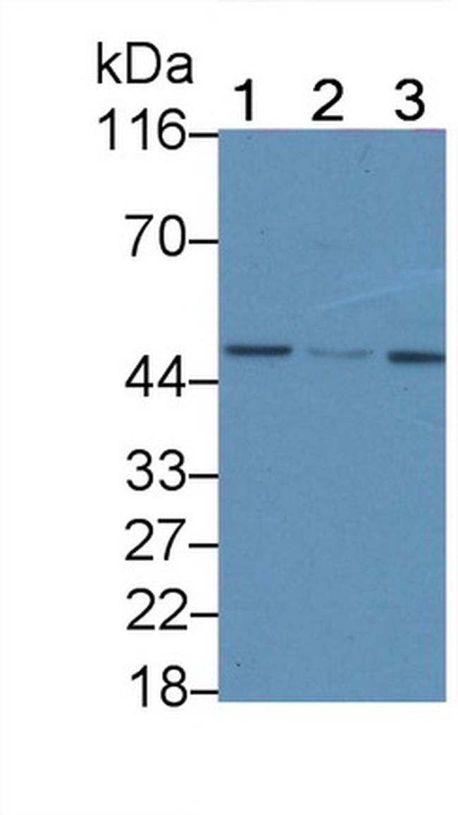 TRAIL-R2 (DR5) Antibody in Western Blot (WB)