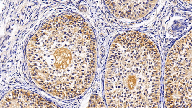 TRAIL-R2 (DR5) Antibody in Immunohistochemistry (Paraffin) (IHC (P))