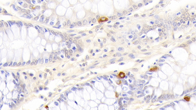 TRAIL-R2 (DR5) Antibody in Immunohistochemistry (Paraffin) (IHC (P))