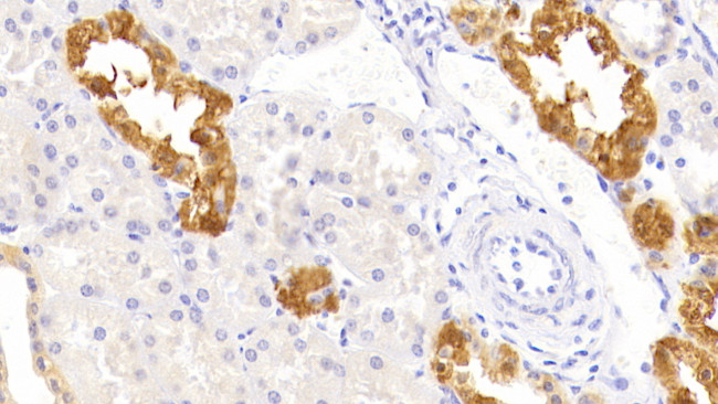 TRAIL-R2 (DR5) Antibody in Immunohistochemistry (Paraffin) (IHC (P))