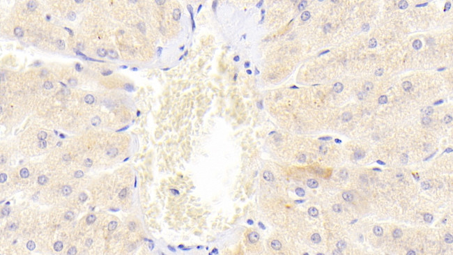 TRAIL-R2 (DR5) Antibody in Immunohistochemistry (Paraffin) (IHC (P))