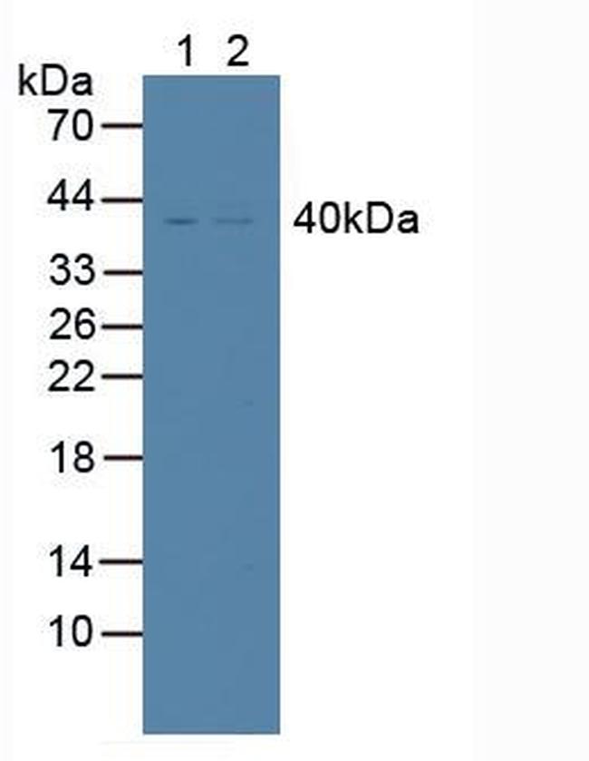 TRAIL-R2 (DR5) Antibody in Western Blot (WB)