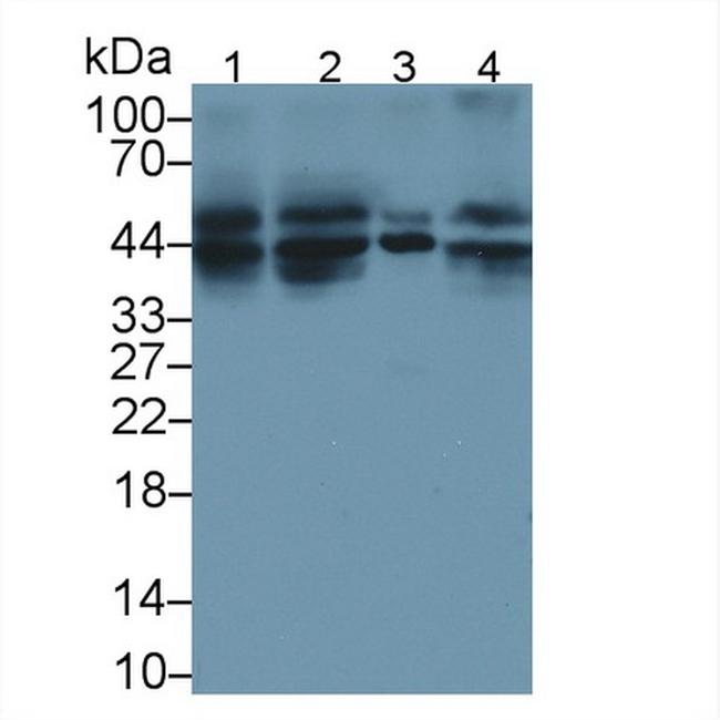 TRAIL-R2 (DR5) Antibody in Western Blot (WB)