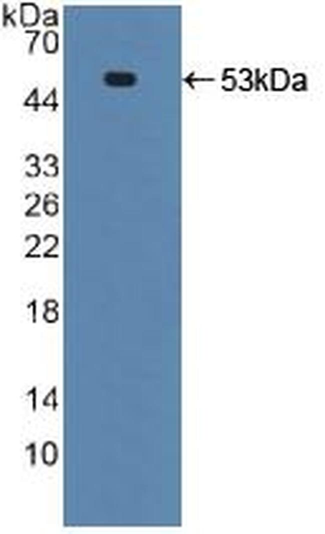 TRAIL-R2 (DR5) Antibody in Western Blot (WB)