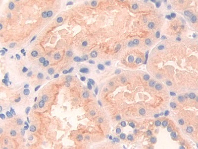 CD148 Antibody in Immunohistochemistry (Paraffin) (IHC (P))