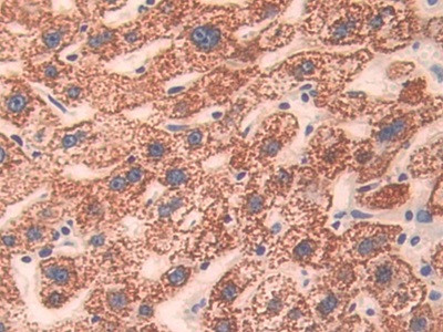 CD148 Antibody in Immunohistochemistry (Paraffin) (IHC (P))