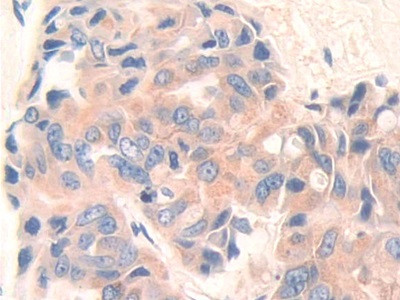 CD148 Antibody in Immunohistochemistry (Paraffin) (IHC (P))