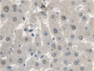 CTBS Antibody in Immunohistochemistry (Paraffin) (IHC (P))