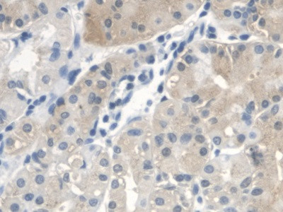 CTBS Antibody in Immunohistochemistry (Paraffin) (IHC (P))