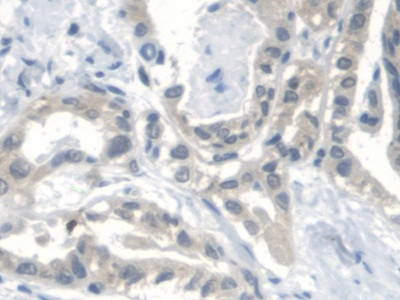 CTBS Antibody in Immunohistochemistry (Paraffin) (IHC (P))