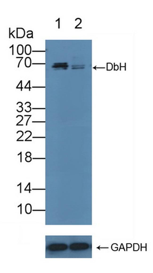 DbH Antibody in Western Blot (WB)