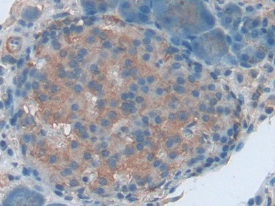 ENPP1 Antibody in Immunohistochemistry (Paraffin) (IHC (P))