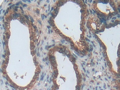 ENPP1 Antibody in Immunohistochemistry (Paraffin) (IHC (P))