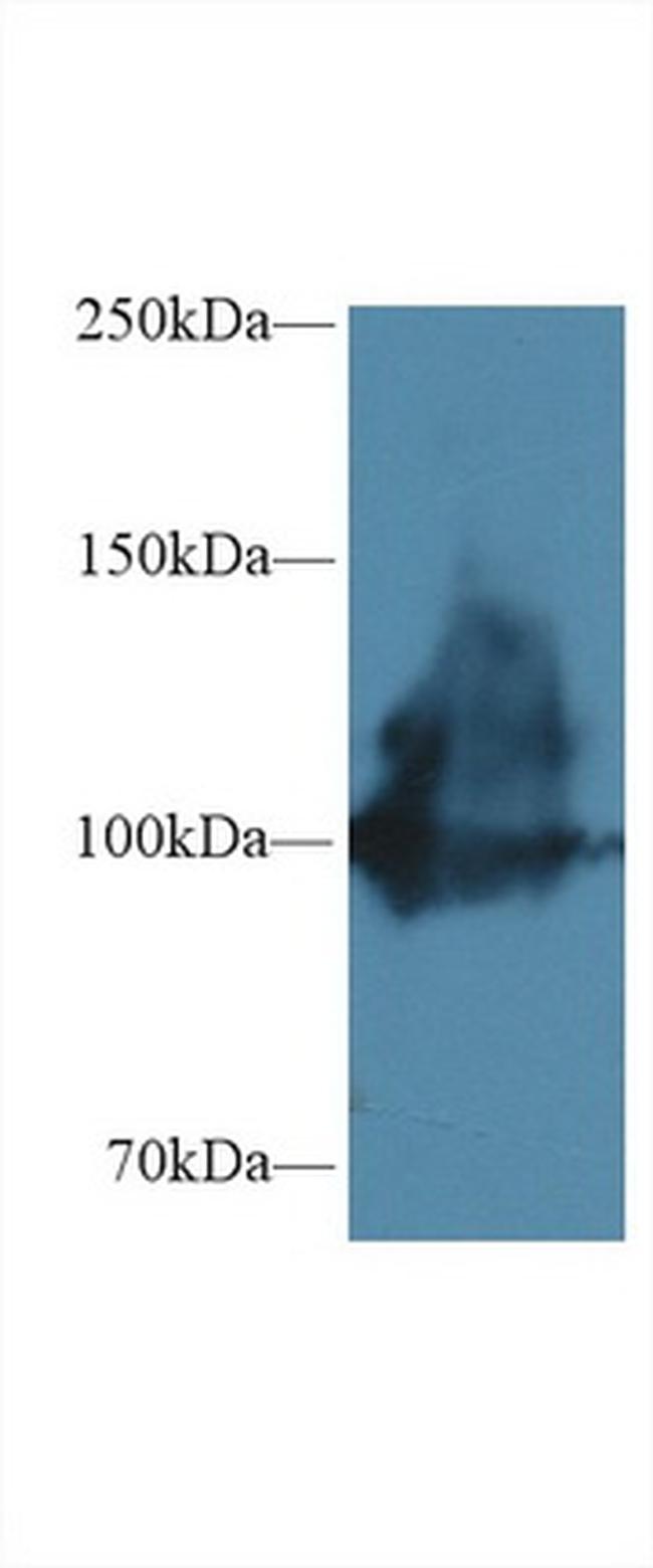 ENPP1 Antibody in Western Blot (WB)