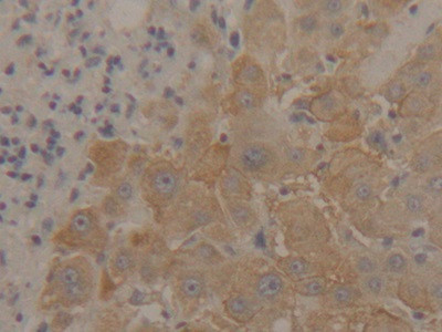 ENO1 Antibody in Immunohistochemistry (Paraffin) (IHC (P))