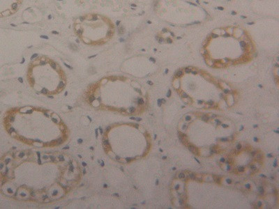 ENO1 Antibody in Immunohistochemistry (Paraffin) (IHC (P))