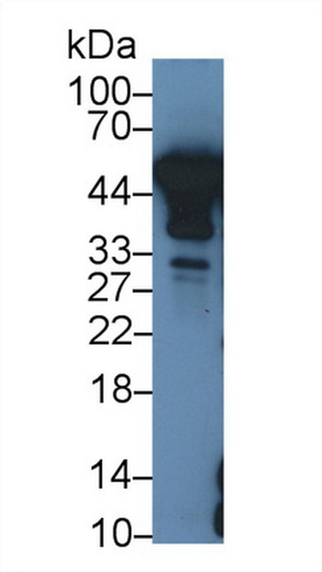 NSE Antibody in Western Blot (WB)