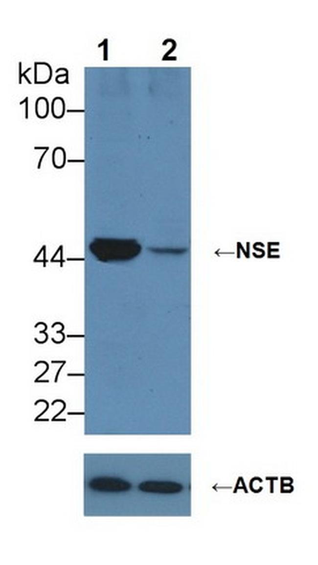 NSE Antibody in Western Blot (WB)