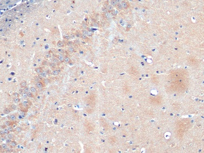 NSE Antibody in Immunohistochemistry (Paraffin) (IHC (P))