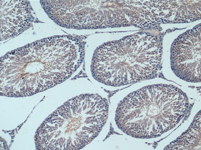 NSE Antibody in Immunohistochemistry (Paraffin) (IHC (P))