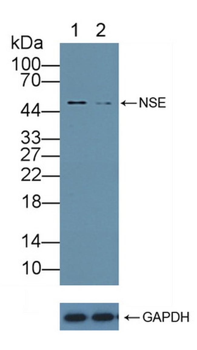 NSE Antibody in Western Blot (WB)