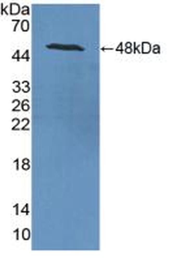 NSE Antibody in Western Blot (WB)