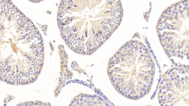 NSE Antibody in Immunohistochemistry (Paraffin) (IHC (P))