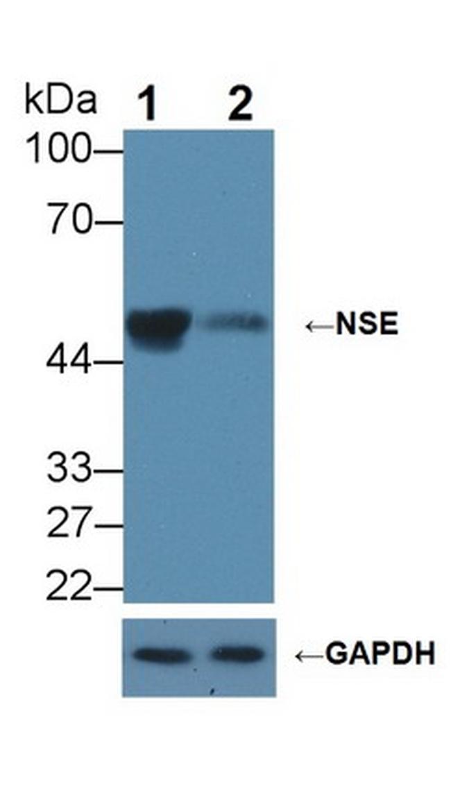 NSE Antibody in Western Blot (WB)