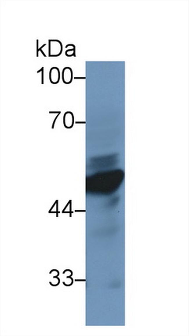 NSE Antibody in Western Blot (WB)