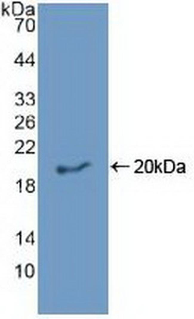 Epiregulin Antibody in Western Blot (WB)