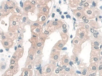 CRM1 Antibody in Immunohistochemistry (Paraffin) (IHC (P))