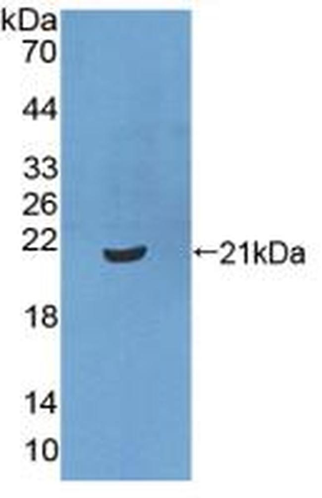 CRM1 Antibody in Western Blot (WB)