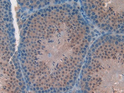 FAM19A2 Antibody in Immunohistochemistry (Paraffin) (IHC (P))