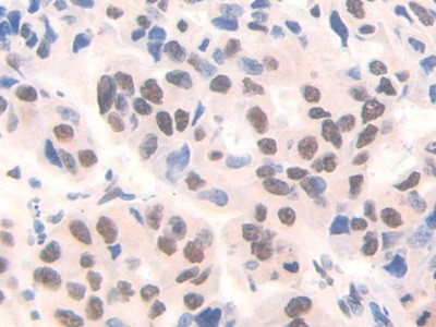 FAM19A3 Antibody in Immunohistochemistry (Paraffin) (IHC (P))