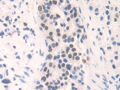 FAM19A3 Antibody in Immunohistochemistry (Paraffin) (IHC (P))