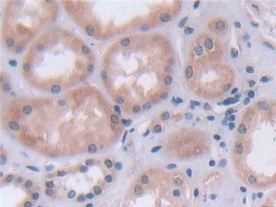 FADS2 Antibody in Immunohistochemistry (Paraffin) (IHC (P))