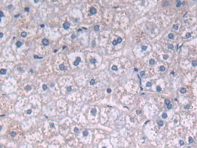 FADS2 Antibody in Immunohistochemistry (Paraffin) (IHC (P))