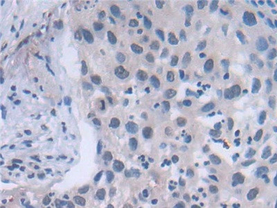 FADS2 Antibody in Immunohistochemistry (Paraffin) (IHC (P))