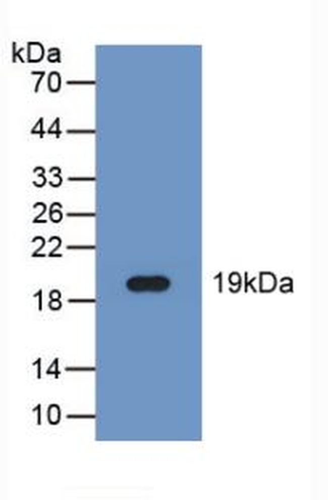 FADS2 Antibody in Western Blot (WB)