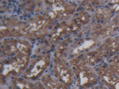 Ferritin Heavy Chain Antibody in Immunohistochemistry (Paraffin) (IHC (P))