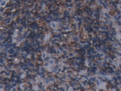 Ferritin Heavy Chain Antibody in Immunohistochemistry (Paraffin) (IHC (P))