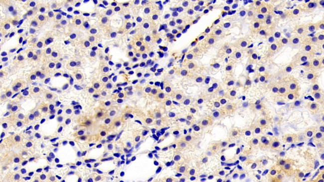 Fibrillarin Antibody in Immunohistochemistry (Paraffin) (IHC (P))