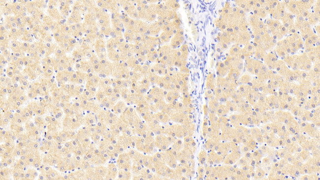 FKBPL Antibody in Immunohistochemistry (Paraffin) (IHC (P))