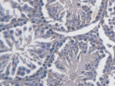 FKBPL Antibody in Immunohistochemistry (Paraffin) (IHC (P))