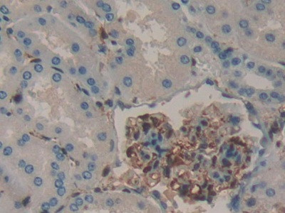 Galectin 1 Antibody in Immunohistochemistry (Paraffin) (IHC (P))