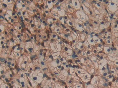 Galectin 1 Antibody in Immunohistochemistry (Paraffin) (IHC (P))