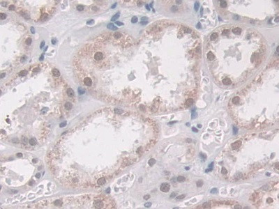 Glucocorticoid Receptor Antibody in Immunohistochemistry (Paraffin) (IHC (P))