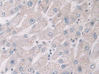 Glucocorticoid Receptor Antibody in Immunohistochemistry (Paraffin) (IHC (P))