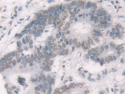 Glucocorticoid Receptor Antibody in Immunohistochemistry (Paraffin) (IHC (P))